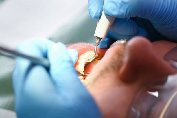 Best Weekend Emergency Dentist in Mcgregor, TX